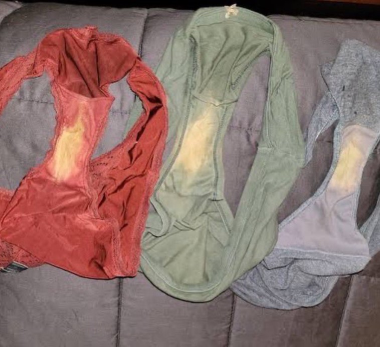 This is what it means if you find a “bleach” spot on your underwear My Blog