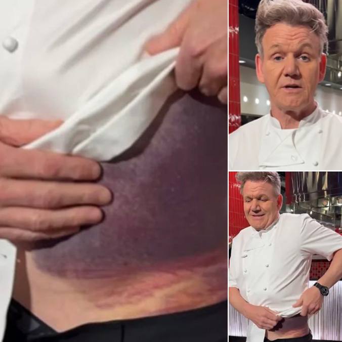 Gordon Ramsay Shares Important Message After Potentially Fatal Accident   448671755 122123380982289385 3336315900487691979 N 